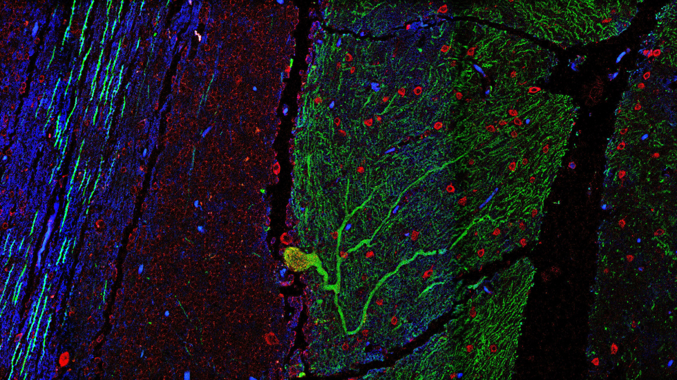 Image of stained tissue from human cerebellum